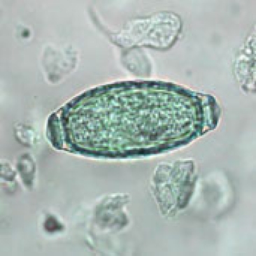 Immagine ingrandita al microscopio di un verme della vescica del gatto